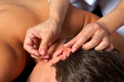 acupuncture3